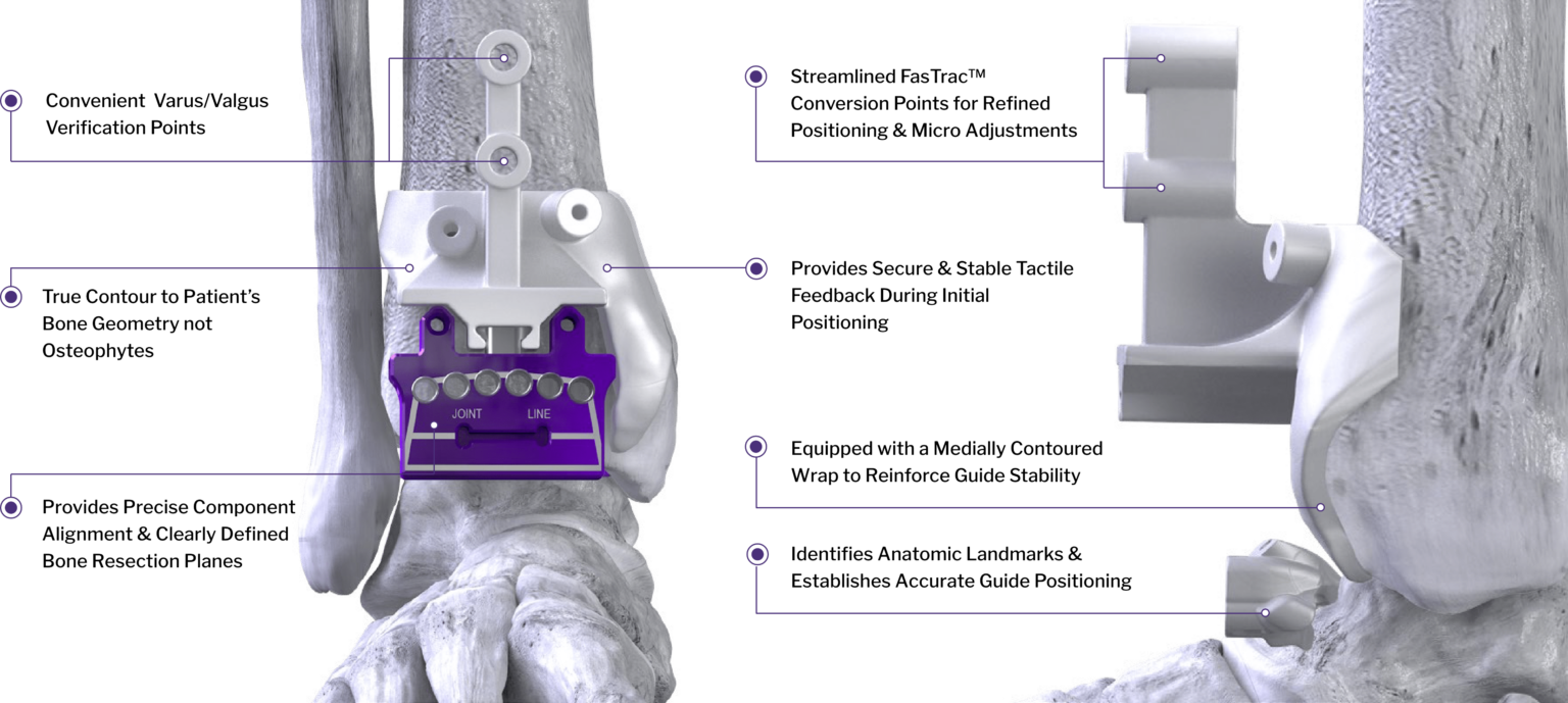 Smart28 MAVEN™ Patient Specific Instrumentation (PSI) – SMART28℠