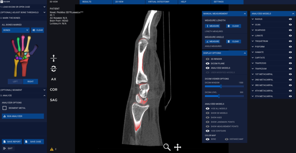 dicom-compare-model-new_orig Image