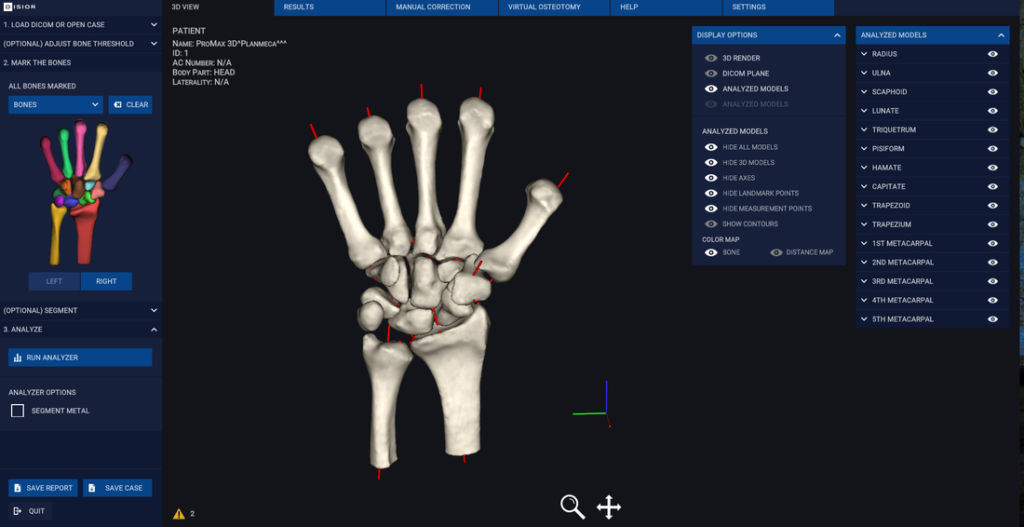 hand-result_orig Image