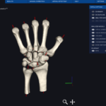 hand-result_orig Image