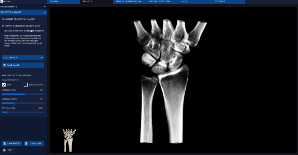 handprojections_orig Image