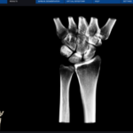 handprojections_orig Image