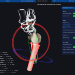 osteotomy-2-6_orig Image